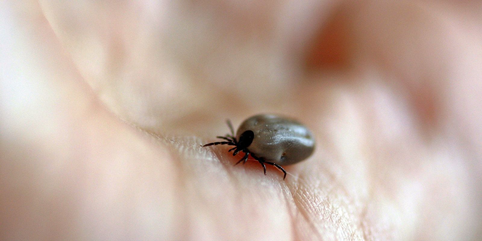 Parque é fechado em salto após mortes por febre maculosa