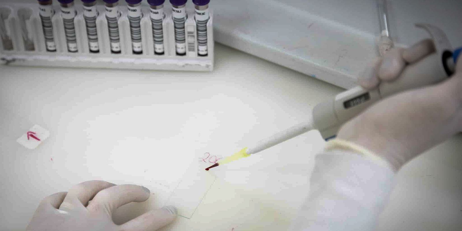 Fim do alarme: exames descartam ebola em paciente internado em São Paulo