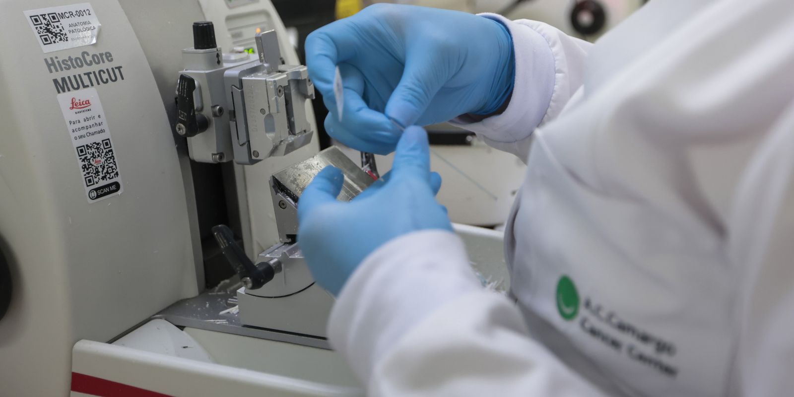 SUS aprova tratamento inédito para pacientes com leucemia mieloide aguda